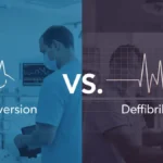 Difference Between Cardioversion and Defibrillation